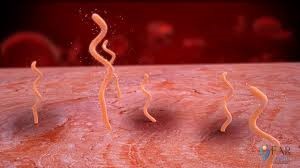Borrelia Burgdorferi