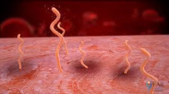 Borrelia burgdorferi Lyme Ct