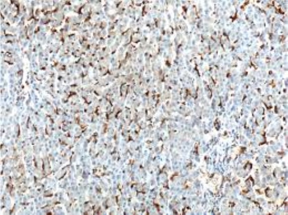 Single Chain anti-CD16 Recombinant Antibody