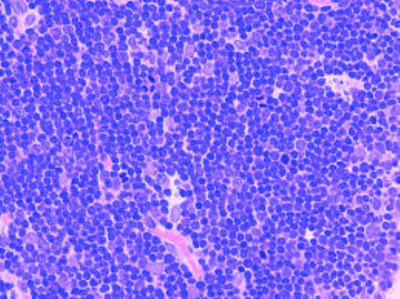 anti-Cortical thymocytes