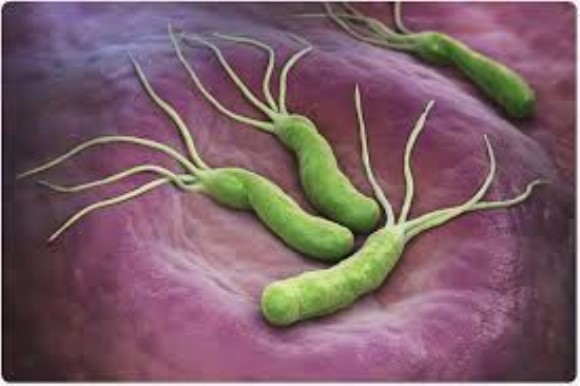 H.pylori CagA recombinant antigen