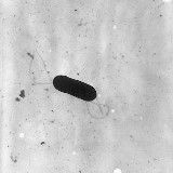 Listeria monocytogenes 