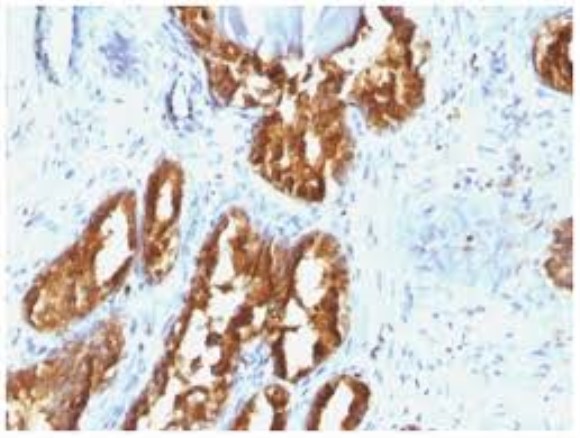 Prostatic acid phosphatase - full length (human)