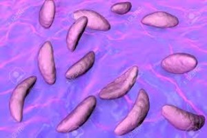 Toxoplasma gondii P24 (GRA1) recombinant antigen
