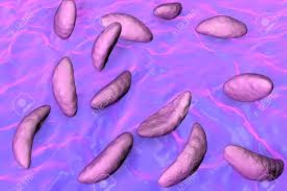 Toxoplasma gondii P24 (GRA1) recombinant antigen
